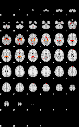 Patients 29458 30