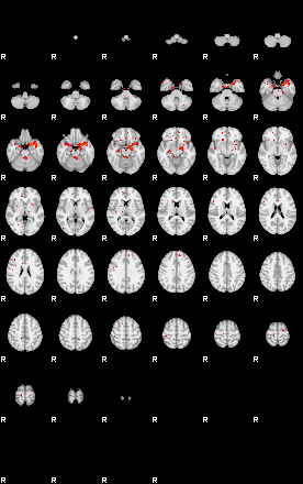 Patients 29497 199