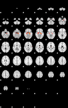 Patients 29514 47