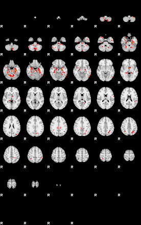 Patients 29540 122