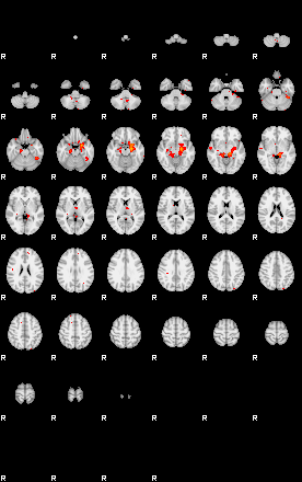 Patients 29660 175