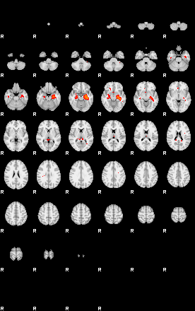 Patients 29665 95