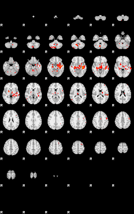 Patients 29871 84