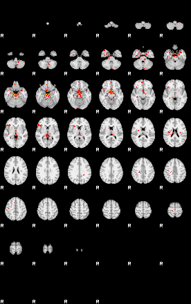 Patients 30017 35