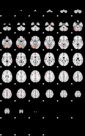 Patients 29150 90