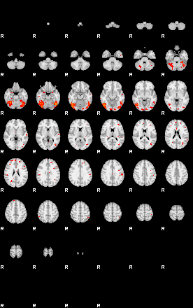 Patients 29280 128