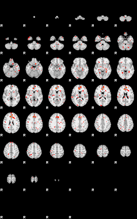 Patients 29584 133