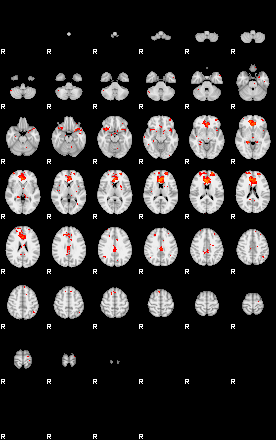 Patients 30014 74