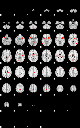 Patients 28795 1