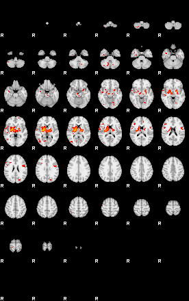 Patients 28809 93