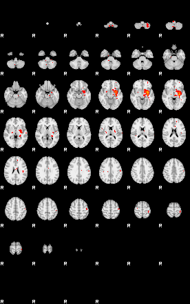 Patients 28859 193