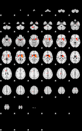 Patients 28905 127