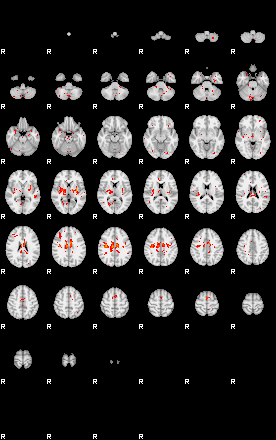 Patients 28920 79