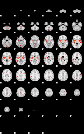 Patients 28941 52