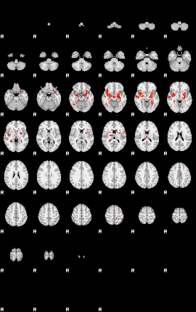 Patients 29008 52