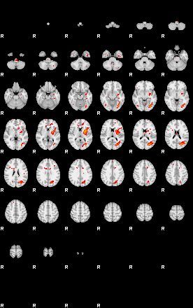 Patients 29070 120