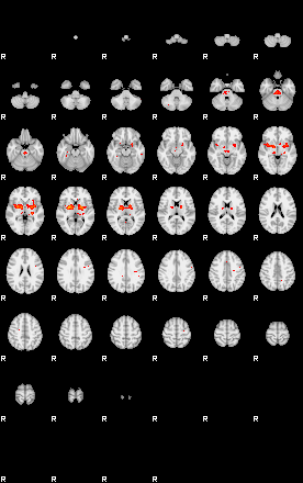 Patients 29106 120