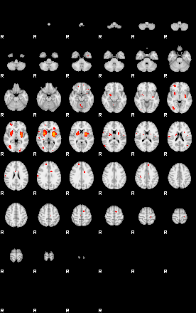 Patients 29107 123