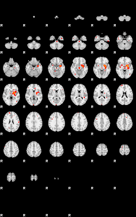 Patients 29108 120