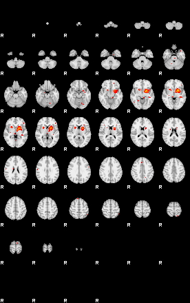 Patients 29150 193