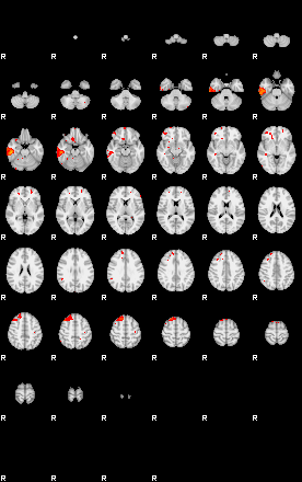 Patients 29162 148