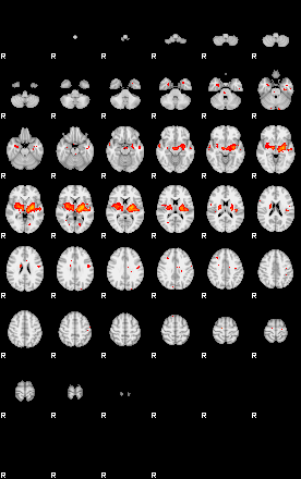 Patients 29165 139