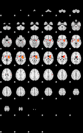 Patients 29173 130