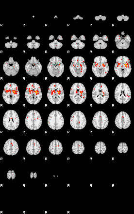 Patients 29178 124