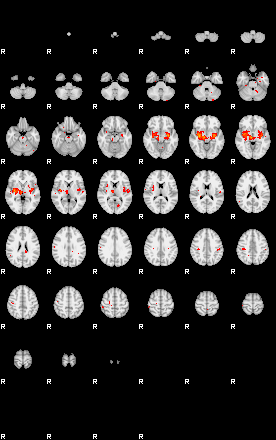 Patients 29185 51