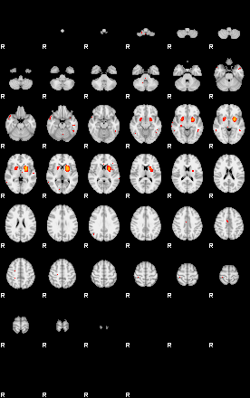 Patients 29186 135