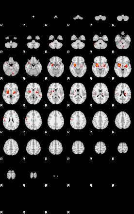 Patients 29187 55