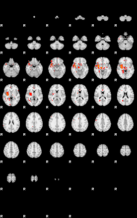 Patients 29409 45