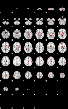 Patients 29610 191