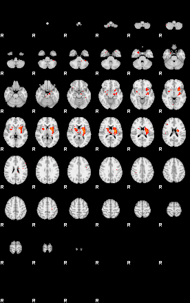 Patients 29794 124