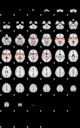 Patients 30002 35