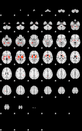 Patients 30018 137