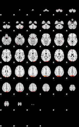 Patients 29041 13