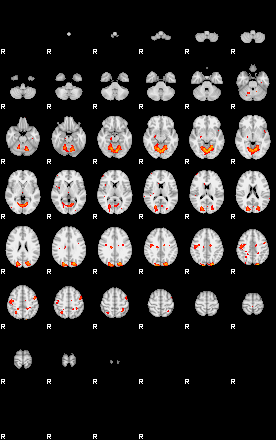 Patients 29175 96