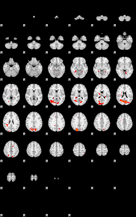 Patients 29180 112