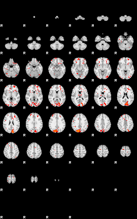 Patients 29623 14