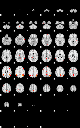 Patients 29012 172