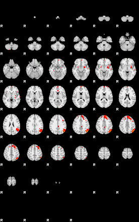 Patients 29029 18