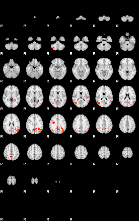 Patients 29100 113