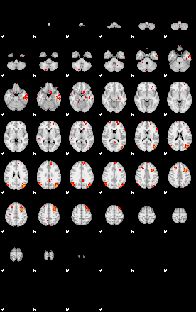 Patients 29160 34