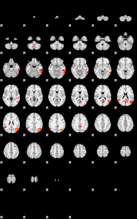 Patients 29162 128