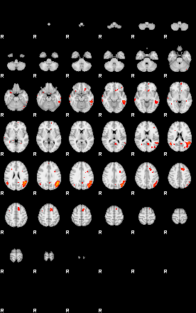 Patients 29163 123