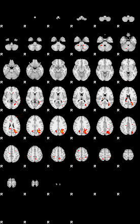 Patients 29166 160