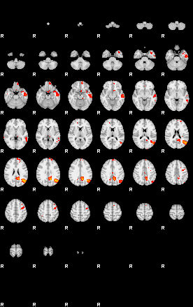 Patients 29169 124