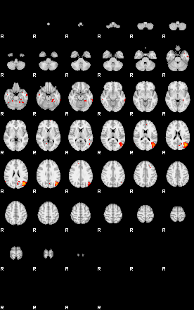 Patients 29173 121