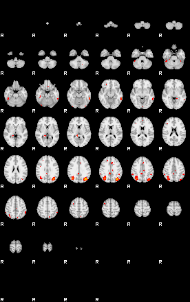 Patients 29173 2